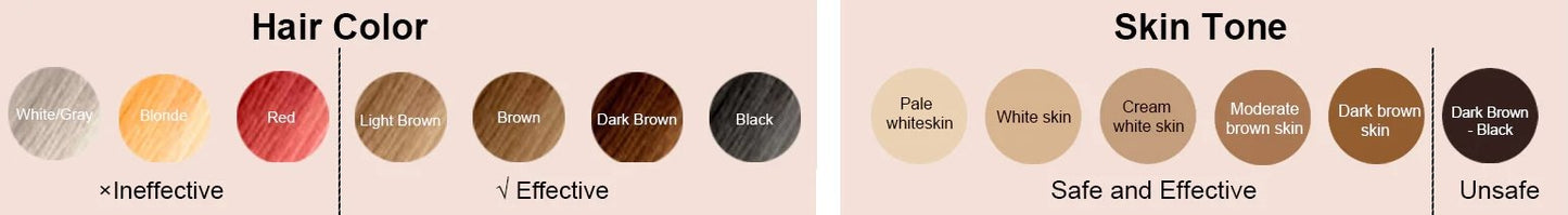 Shape Tactics Portable IPL Laser Hair Removal System